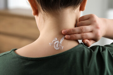 Woman applying ointment onto her neck indoors, closeup