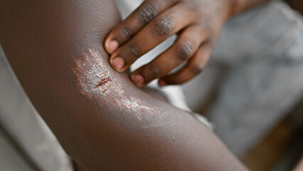 African american man sitting on sofa touching wound on arm at home