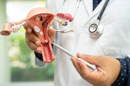 Uterus, doctor holding anatomy model for study diagnosis and treatment in hospital.