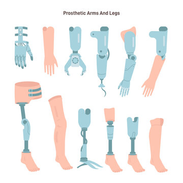 Artificial limbs types set. Prosthesis for arm and legs. Biotechnology for disabled