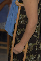 Obraz na płótnie Canvas mujer latina con muletas por una lesión en rodilla