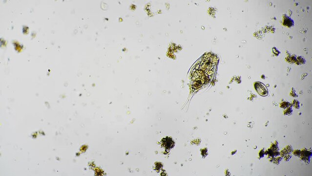 Rotifer and infusoria are moving and eating algae and other microorganism filmed in macro. High magnification of protozoa living in fresh water. Planktons under microscope. Microbiology concept