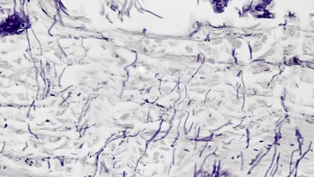 Footage of the skin section surrounding hair follicle using a microscope at 400x magnification on a bright field. Observe and analyze various layers of cells focusing on sebaceous glands and epidermis