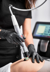 Close up of cosmetologist hands using radiofrequency microneedling device while removing stretch...