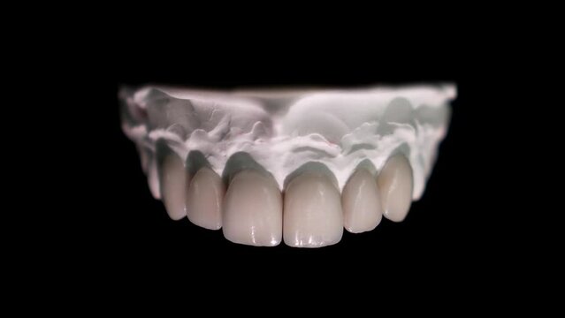 A beautiful Ceramic dental veneers on black background zirconium reveal shot