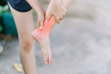 A woman has ankle pain due to an injury from a fall.