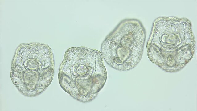 Larvae sea urchin Strongylocentrotus pallidus under microscope, phylum Echinodermata. Prism stage. White sea