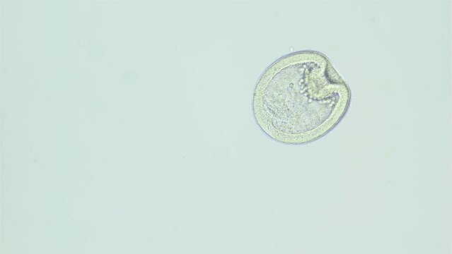 Larvae sea urchin Strongylocentrotus pallidus under microscope, phylum Echinodermata. Gastrula stage. White sea