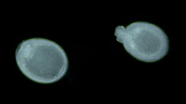 Larvae sea urchin Strongylocentrotus pallidus under microscope, phylum Echinodermata. Gastrula stage. White sea