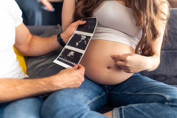 Close up of exposed baby bump as mother points her finger to it and the father is holding up a...