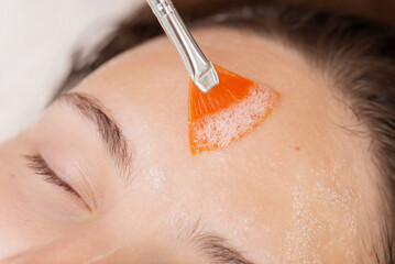 Performing carboxy therapy procedure for a female client in cosmetology clinic. Applying special...