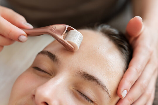 Microneedle mesotherapy in cosmetological clinic. Doctor cosmetologist using roller with micro needles for stimulation of skin regeneration and introduction of various rejuvenating drugs