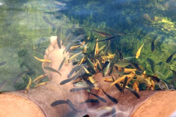 Fish Therapy, Removes dead skin cells and stimulates the growth of new skin cells.