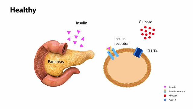 Insulin action and diabetes type 1 and 2, 2d 3d animation, render, metabolic diseases, pancreatic disease, insulin receptors, pancreas