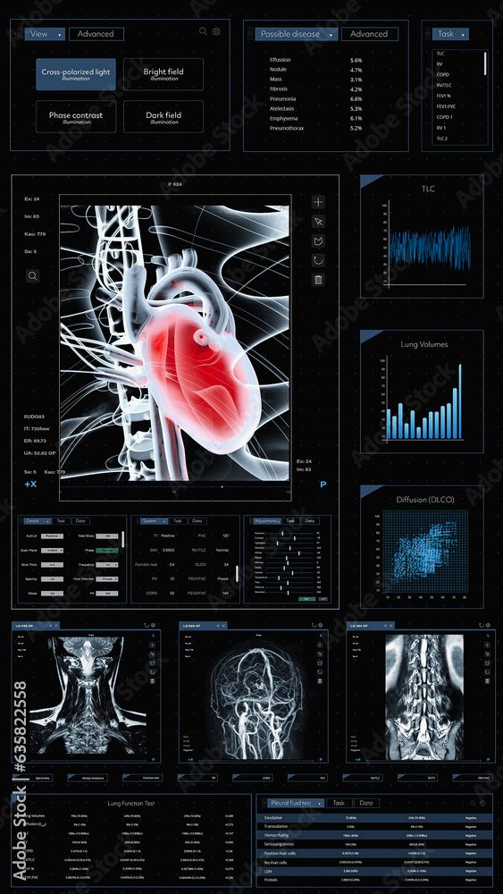 Aufkleber 3D Render Vertical Screen: Mobile Health Monitoring Medical Software Interface For Doctors. Smartphone Application With X-ray, MRIs of Brain And Spinal Cord. App Tracking Vitals During Heart Surgery