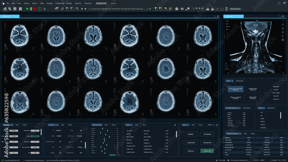 Poster 3D Render: Magnetic Resonance Imaging Brain Scan Mock-up with Multiple Windows and Data. Professional Medical Research Software Template with MRI Results for Computer Displays and Laptop Screens.