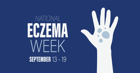 National Eczema Week. September 13 - 19, 2023 vector awareness campaign banner.