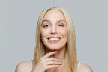 Blonde model woman with young clean skin and wrinkles. Aging and youth, aesthetic surgery, beauty...