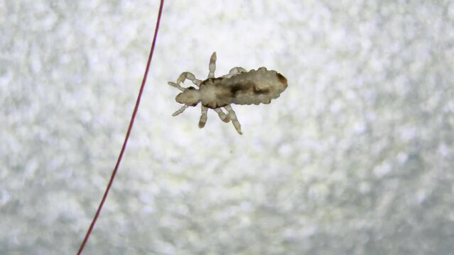 Head louse walking on white bumpy surface bellow human hair. Extreme closeup detail of human parasite. Pediculus capitis. Human infectious disease.