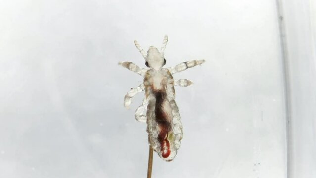 Head louse on a the top of human hair with detail of internal organs movemnet with blood inside. Extreme closeup detail of human parasite. Pediculus capitis. Human infectious disease.