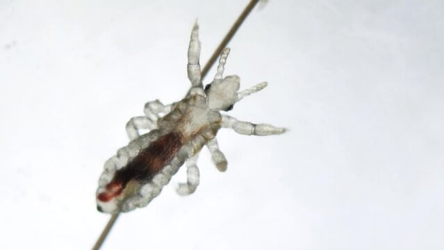 Detail look on head louse on a human hair with movement in her internal organs, and blood inside. Extreme closeup detail of human parasite. Pediculus capitis. Human infectious disease.