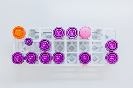 View from above reagent tubes