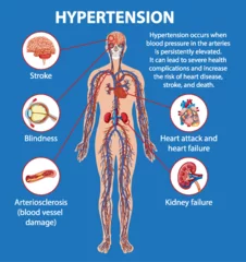 Fototapete Kinder Science Education on Hypertension's Effects on Human Anatomy