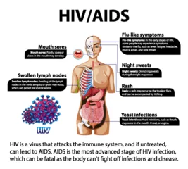 Fototapete Kinder HIV/AIDS Virus: Effects on Human Immune System