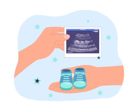Hands of parents with baby shoes and ultrasound scan. Hands of future mother and father with child boots and baby scan vector illustration. Pregnancy, childbirth, medicine, parenthood concept