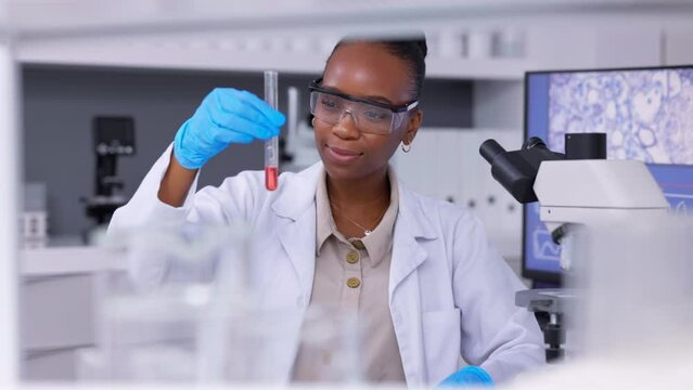Medical, scientist and vials with black woman, research and chemistry experiment in a laboratory. Healthcare, liquid and scientist with data analysis and expert testing sample, study and bacteria