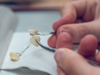 Dental technician with parts of ceramic tooth