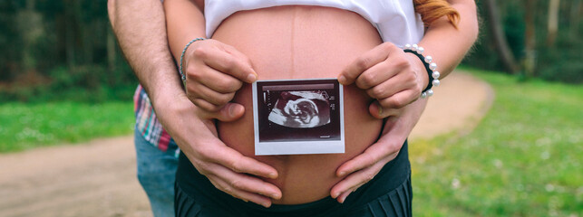 Unrecognizable latin female pregnant showing ultrasound scan of her baby while her partner holding her belly with hands on nature