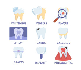 Set of teeth procedures. Medical infographics and materials. Caries, calculus, implant and braces. Oral hygiene and dentistry. Cartoon flat vector collection isolated on white background