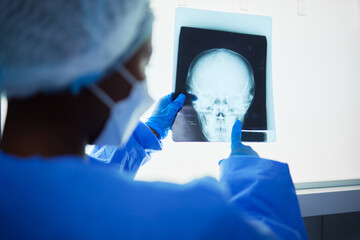 Brain xray, medical doctor and surgery charts, test results and healthcare analysis of the head....
