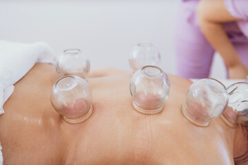 Professional female therapist doing hijama treatment on patient back. Putting heated vacuum cups to heal chronic pain.