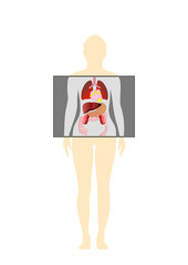 X-ray of woman's internal organs 