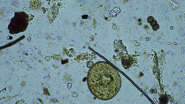 microorganisms under the microscope in a sample