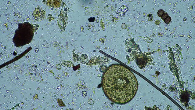 microorganisms close up under the microscope. in a soil sample from a farm