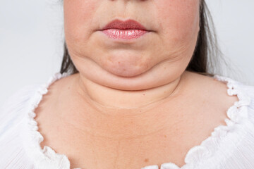 Double chin face mature woman 50 years old, human fat neck, wrinkles on skin, facelift, age-related...