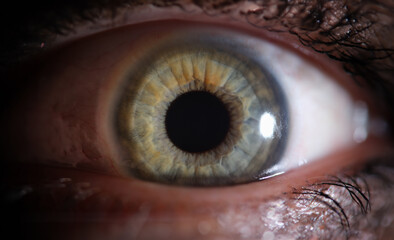 Person eye with beautiful green grey shades macro. Hyperopia myopia astigmatism and laser vision...