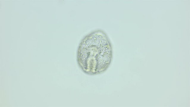 Larvae sea urchin Strongylocentrotus pallidus under microscope, phylum Echinodermata. Late gastrula stage. White sea