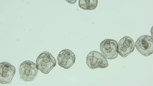 Larvae sea urchin Strongylocentrotus pallidus under microscope, phylum Echinodermata. Prism stage. White sea
