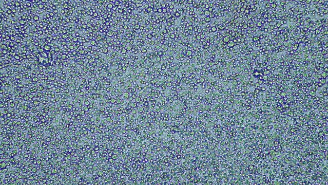 Breast milk under the microscope, woman lactating milk Feeding a baby. Protein and fatty acid lipids, with bacteria in human baby&rsquo;s milk. Microorganisms in milk under, with round bacteria, in America.