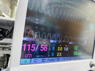 Hospital monitor displays vital signs: heart rate, blood pressure, and more. Symbolizes patient...