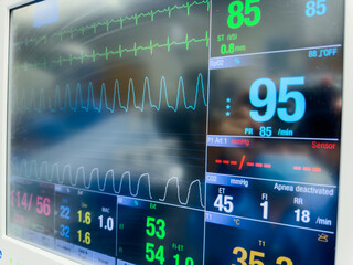 Hospital monitor displays vital signs: heart rate, blood pressure, and more. Symbolizes patient health tracking and medical vigilance.