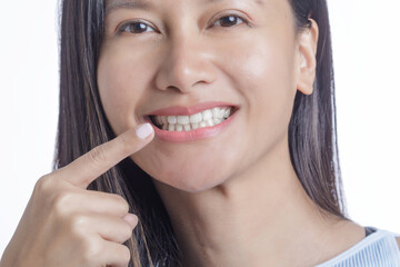 Asian American Woman pointing her perfect white Teeth