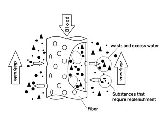 ダイアライザのイメージイラスト