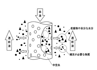 ダイアライザのイメージイラスト