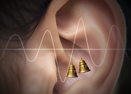 Tinnitus, conceptual illustration
