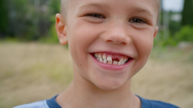 A boy without a front tooth smiles, laughs and rejoices, experiencing positive emotions, taken in close-up.